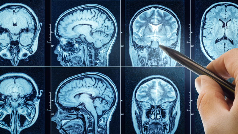 Medical, science and mri brain background